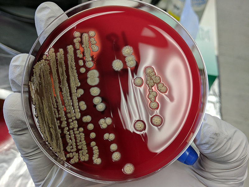 petri dish with bacteria growing